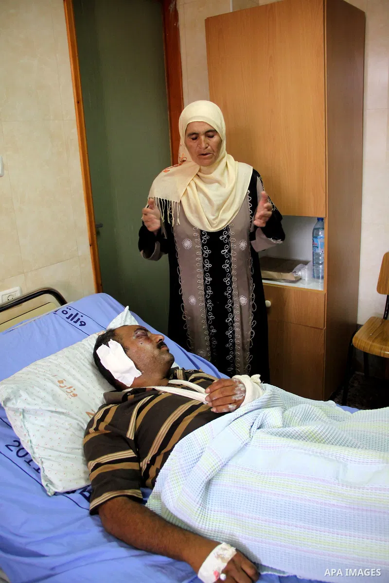 A palestinian Akram Bani Odeh "35" in Rafidia hospital, after he was attacked by Israeli settlers attack Palestinian farmers in the West Bank city of Nablus, on Sep. 16, 2012. Photo by Nedal Eshtayah