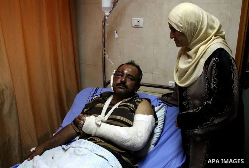 A palestinian Akram Bani Odeh "35" in Rafidia hospital, after he was attacked by Israeli settlers attack Palestinian farmers in the West Bank city of Nablus, on Sep. 16, 2012. Photo by Nedal Eshtayah