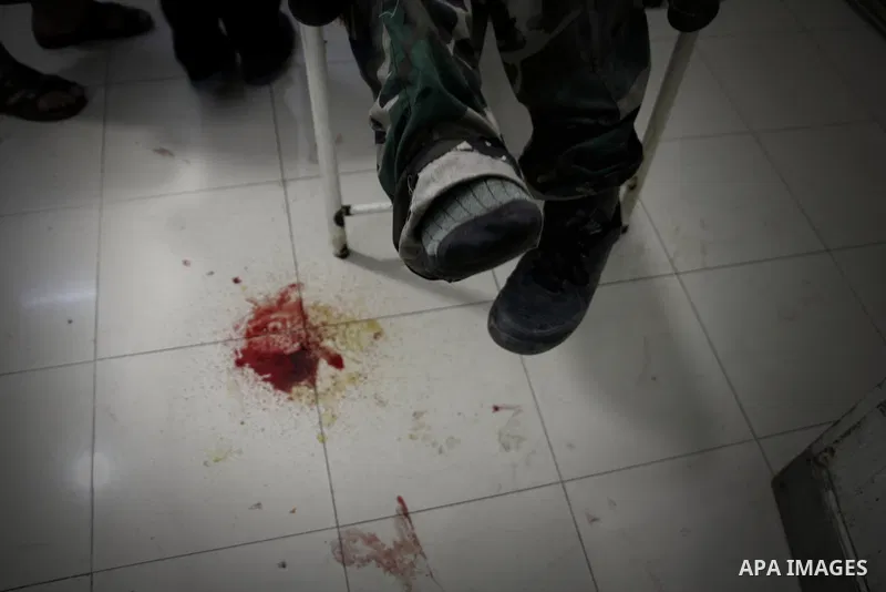 A Free Syrian fighter is brought to the Dar al-Shifa hospital in the northern city of Aleppo to be treated for his wounds on September 27, 2012, as fighting in Syria's second largest city between rebel forces and governm...