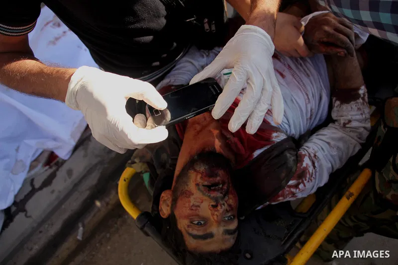 A Free Syrian fighter is brought to the Dar al-Shifa hospital in the northern city of Aleppo to be treated for his wounds on September 27, 2012, as fighting in Syria's second largest city between rebel forces and governm...