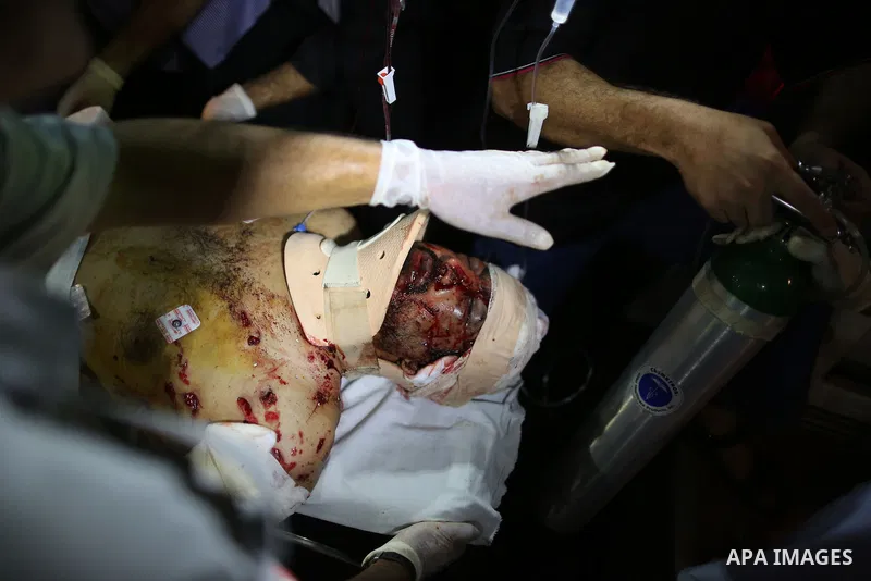 Palestinian medics check a wounded man at Kamal Odwan hospital in northen Gaza strip following an Israeli airstrike in northern town of Jabaliya, in the Gaza Strip, on October 13, 2012. The air strike killed one Palestin...