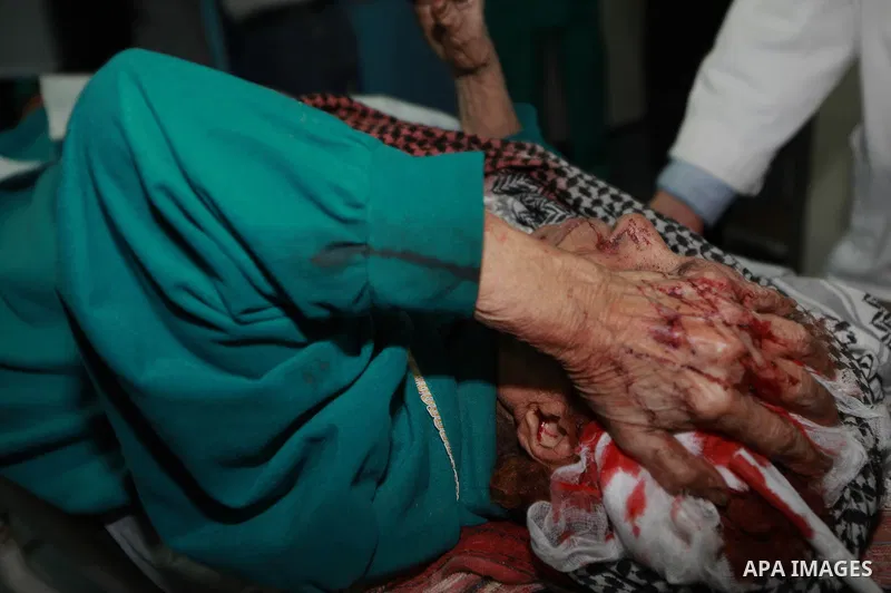 A Palestinian wounded woman lies on a hospital bed into the treatment room of Shifa hospital following an Israeli airstrike in Gaza City, Wednesday, Nov. 14, 2012. The Israeli military said its assassination of the Hamas...