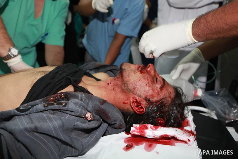 Palestinian medics treat a wounded man into the treatment room of Shifa hospital following an Israeli airstrike in Gaza City, Wednesday, Nov. 14, 2012. The Israeli military said its assassination of the Hamas military co...