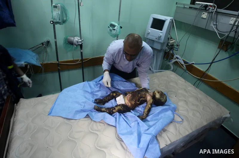 A Palestinian doctor stands near a11-month-old baby boy Omar al-Masharawi, who according to hospital officials was killed in an Israeli air strike in Gaza City November 14, 2012. Israel launched a major offensive against...