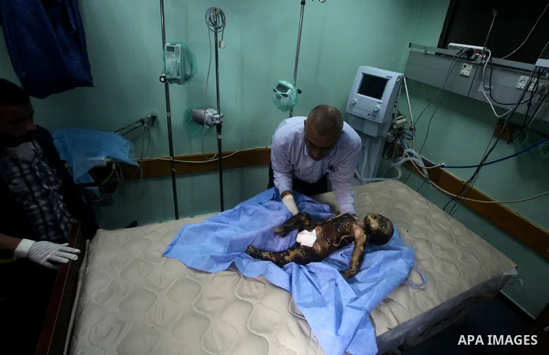 A Palestinian doctor stands near a11-month-old baby boy Omar al-Masharawi, who according to hospital officials was killed in an Israeli air strike in Gaza City November 14, 2012. Israel launched a major offensive against...