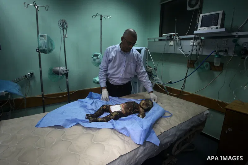 A Palestinian doctor stands near a11-month-old baby boy Omar al-Masharawi, who according to hospital officials was killed in an Israeli air strike in Gaza City November 14, 2012. Israel launched a major offensive against...