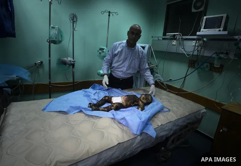 A Palestinian doctor stands near a11-month-old baby boy Omar al-Masharawi, who according to hospital officials was killed in an Israeli air strike in Gaza City November 14, 2012. Israel launched a major offensive against...