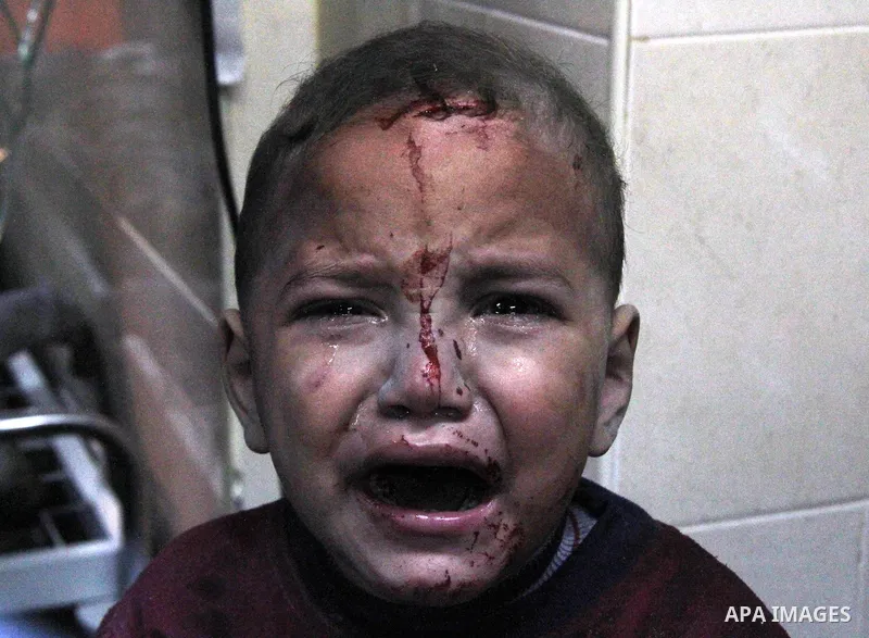 A Palestinian baby boy sits on stretcher at al-Shifa hospital after an Israeli air strike in Gaza city, on November 19, 2012. Israeli air strikes on Sunday killed 31 Palestinians in the bloodiest day so far of its air ca...