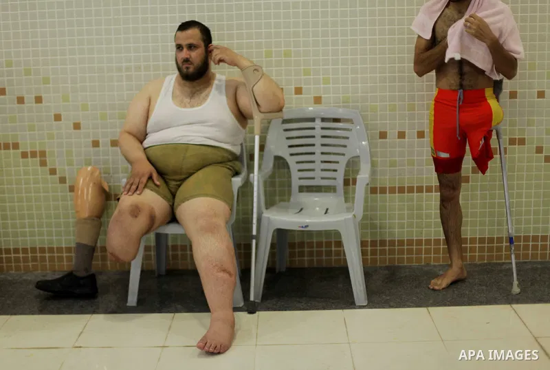 Palestinian Asad Redwan, 31, rests after taks part in a swimming lesson inside al-Sadaka Club in Gaza City May 17, 2013. Al-Masri's leg was amputated after clashes between Palestinians and Israeli soldiers during the fir...