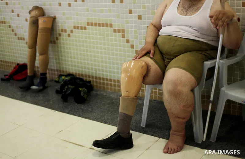 Palestinian Asad Redwan, 31, rests after taks part in a swimming lesson inside al-Sadaka Club in Gaza City May 17, 2013. Al-Masri's leg was amputated after clashes between Palestinians and Israeli soldiers during the fir...