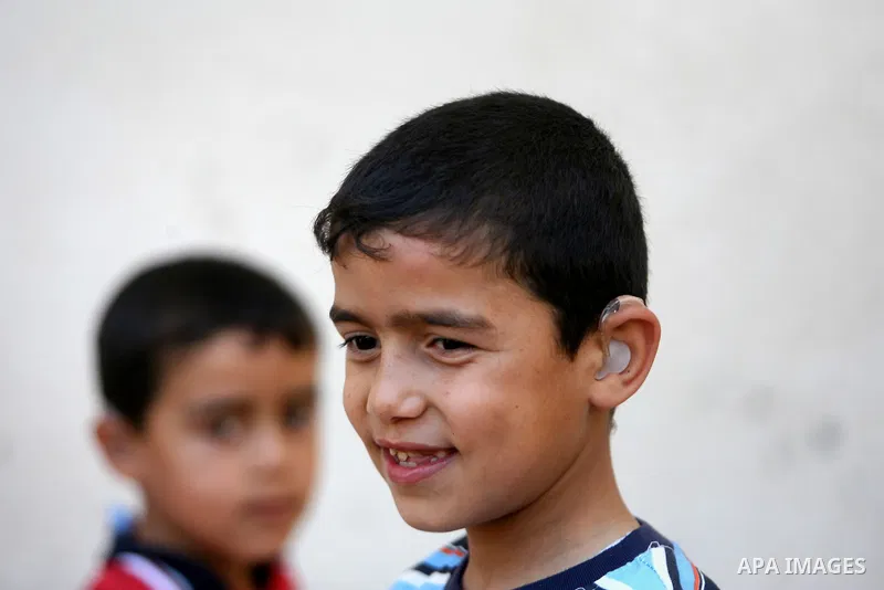 A Palestinian deaf boy shows his ear hearing aid at a deaf center in preparation for implant a cochlear, in Gaza city on May 27, 2013. Cochlear implants may help provide hearing in patients that are not deaf because of d...