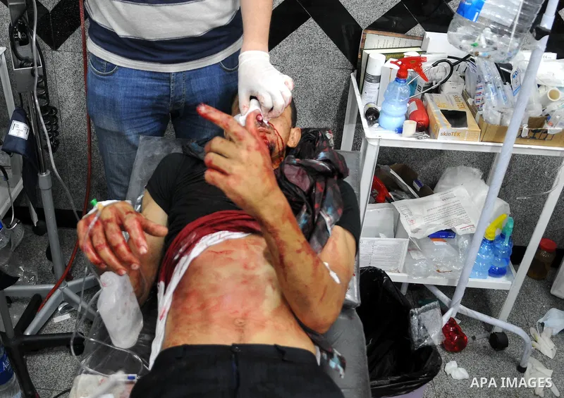 An injured supporter of the deposed Egyptian President Mohamed Morsi receives medical treatment in a makeshift hospital after clashes with riot policemen in Cairo, Egypt, early on July 27, 2013. The death toll of clashes...