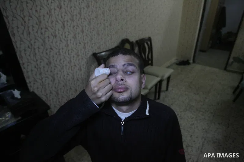Palestinian Mahmoud Juhaish, 23, a blind youth takes his medicine at his house in Rafah refugee camp in southern Gaza strip on Feb. 17, 2014. Juhaish studies at the Islamic University in Gaza City as he suffers blindness...