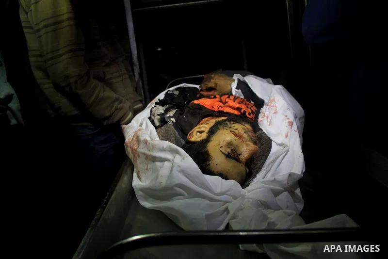 Killed Palestinian Musaad Alzaneen lies in a hospital morgue following an Israeli airstrike on farm land near the town of Beit Hanun in the northern of Gaza Strip, on March 3, 2014. An Israeli air strike on the northern...