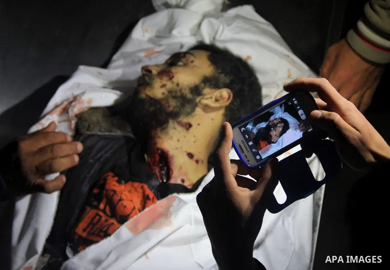 Killed Palestinian Musaad Alzaneen lies in a hospital morgue following an Israeli airstrike on farm land near the town of Beit Hanun in the northern of Gaza Strip, on March 3, 2014. An Israeli air strike on the northern...