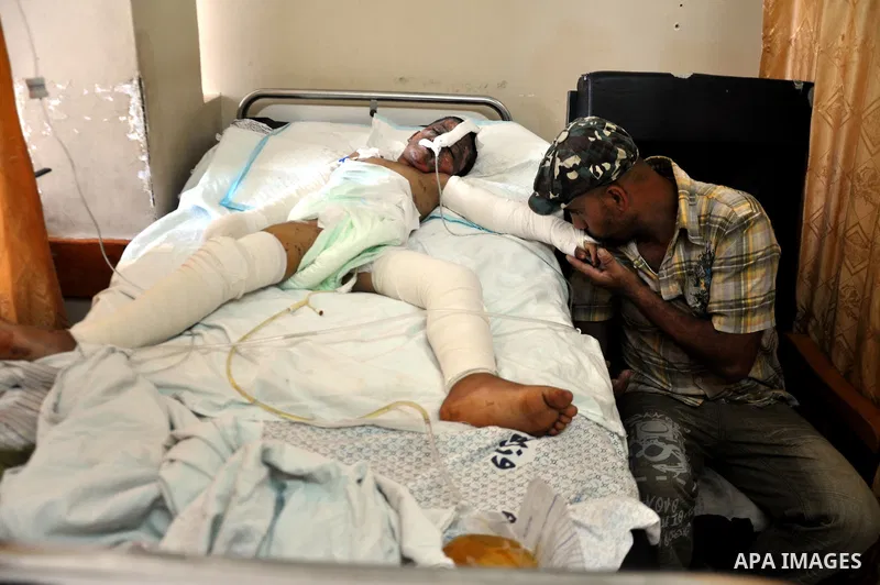 A Palestinian man kisses his son hand, who medics said was wounded in an Israeli air strike, as he receives treatment at al-Shifa hospital in Gaza City on July 22, 2014. The Israeli operation in the Gaza Strip is enterin...