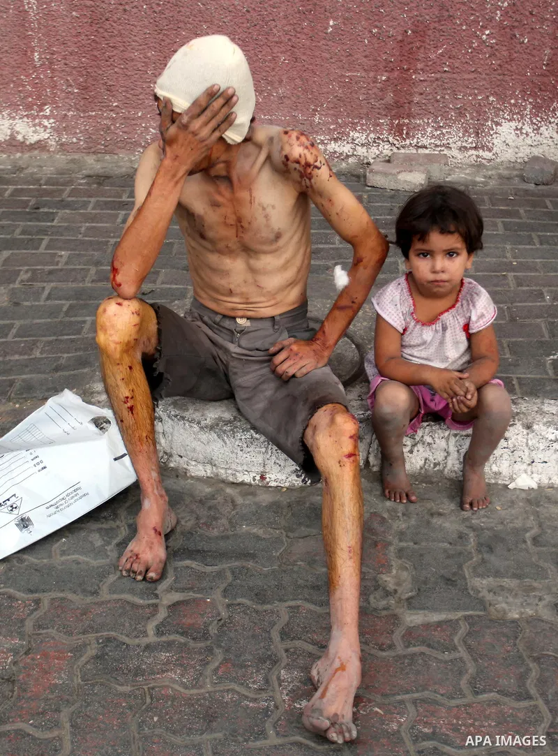 Two Palestinians injured in Israeli air strikes wait outside the Khan Yunis hospital in the southern Gaza Strip on July 29, 2014. The fighting between Israeli troops and Hamas militants raged on unabated with scores more...