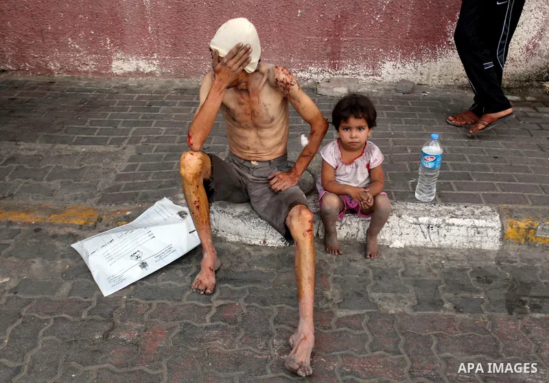 Two Palestinians injured in Israeli air strikes wait outside the Khan Yunis hospital in the southern Gaza Strip on July 29, 2014. The fighting between Israeli troops and Hamas militants raged on unabated with scores more...