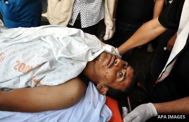 A Palestinian man, receiving treatment in Shifa hospital in Gaza City, on July 29, 2014. Israel's military pounded targets in the Gaza Strip on Tuesday after Prime Minister Benjamin Netanyahu said his country needed to b...