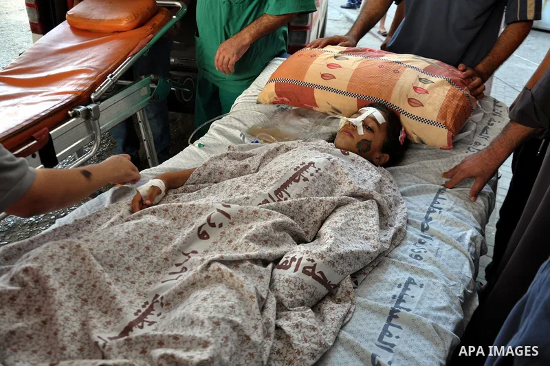 A Palestinian Child receiving treatment in Shifa hospital in Gaza City, on July 29, 2014. Israel's military pounded targets in the Gaza Strip on Tuesday after Prime Minister Benjamin Netanyahu said his country needed to...