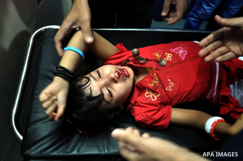 A Palestinian Child receiving treatment in Shifa hospital in Gaza City, on July 29, 2014. Israel's military pounded targets in the Gaza Strip on Tuesday after Prime Minister Benjamin Netanyahu said his country needed to...