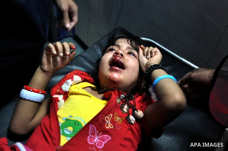 A Palestinian Child receiving treatment in Shifa hospital in Gaza City, on July 29, 2014. Israel's military pounded targets in the Gaza Strip on Tuesday after Prime Minister Benjamin Netanyahu said his country needed to...