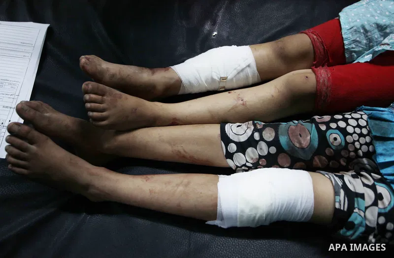 Palestinian girls who were wounded in an Israeli strike on a compound housing a UN school in Jabalia refugee camp in the northern Gaza Strip, wait for treatment at the Kamal Edwin hospital in Beit Lahia where victims fro...