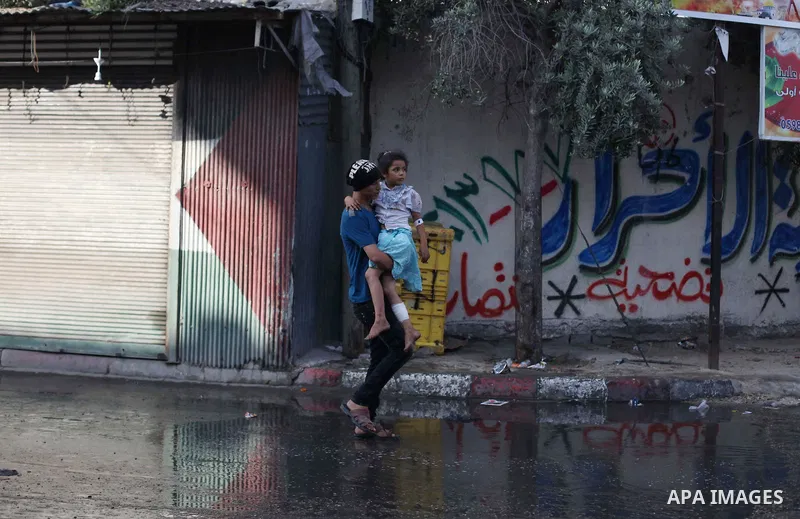 A Palestinian boy, whom medics said was wounded in an Israeli air strike on a compound housing a UN school in Jabalia refugee camp in the northern Gaza Strip, receives treatment at the Kamal Edwin hospital in Beit Lahia...