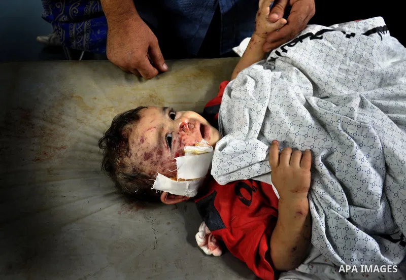 Palestinian medics treat children for their injuries caused by an Israeli strike at a house, at the El-Shifa hospital in Gaza City, Wednesday, July 30, 2014. Several Israeli tank shells slammed into the crowded U.N. scho...
