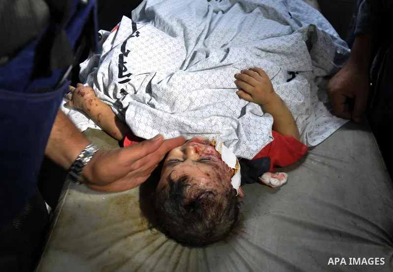 Palestinian medics treat children for their injuries caused by an Israeli strike at a house, at the El-Shifa hospital in Gaza City, Wednesday, July 30, 2014. Several Israeli tank shells slammed into the crowded U.N. scho...