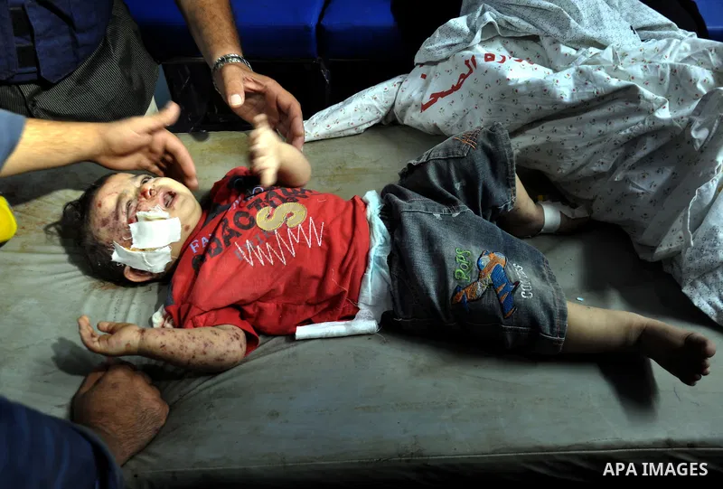 Palestinian medics treat children for their injuries caused by an Israeli strike at a house, at the El-Shifa hospital in Gaza City, Wednesday, July 30, 2014. Several Israeli tank shells slammed into the crowded U.N. scho...