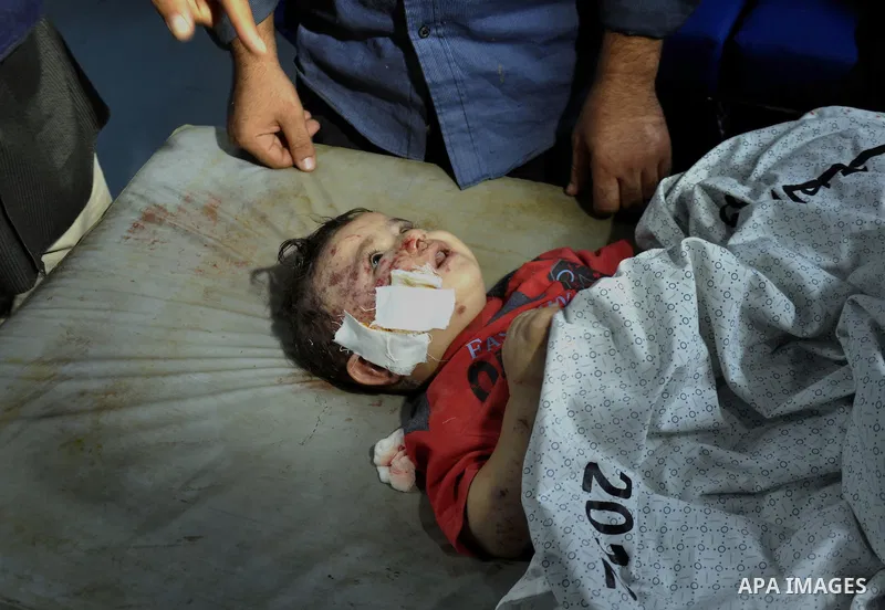 Palestinian medics treat children for their injuries caused by an Israeli strike at a house, at the El-Shifa hospital in Gaza City, Wednesday, July 30, 2014. Several Israeli tank shells slammed into the crowded U.N. scho...