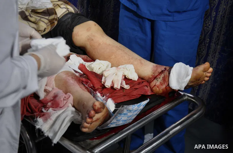 Palestinian medics treat children for their injuries caused by an Israeli strike at a house, at the El-Shifa hospital in Gaza City, Wednesday, July 30, 2014. Several Israeli tank shells slammed into the crowded U.N. scho...