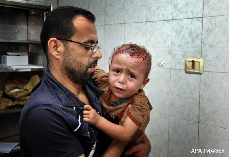 Palestinian medics treat children for their injuries caused by an Israeli strike at a house, at the El-Shifa hospital in Gaza City, Wednesday, July 30, 2014. Several Israeli tank shells slammed into the crowded U.N. scho...