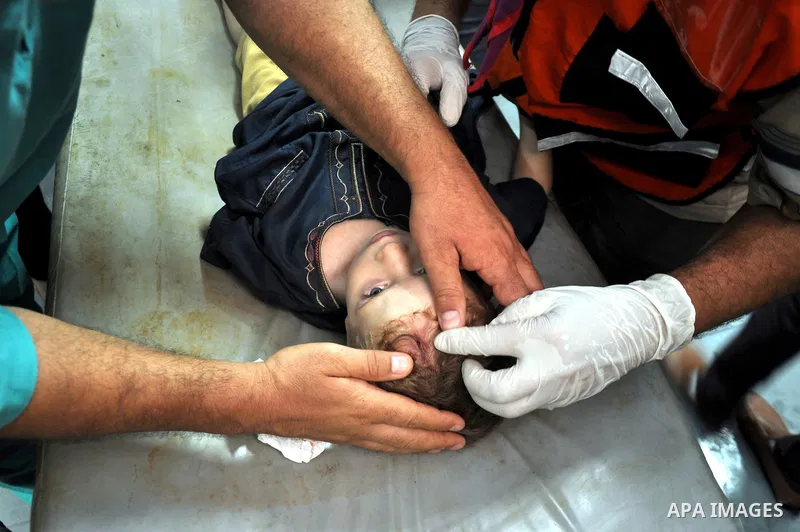 Palestinian medics treat children for their injuries caused by an Israeli strike at a house, at the El-Shifa hospital in Gaza City, Wednesday, July 30, 2014. Several Israeli tank shells slammed into the crowded U.N. scho...