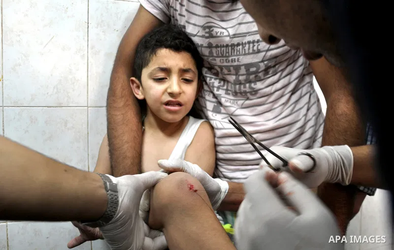 Palestinian medics treat children for their injuries caused by an Israeli strike at a house, at the El-Shifa hospital in Gaza City, Wednesday, July 30, 2014. Several Israeli tank shells slammed into the crowded U.N. scho...