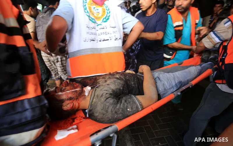 Palestinian medics wheel a wounded man, following an Israeli Strike in Shijaiyah neighborhood, to the emergency room of the Shifa Hospital, in Gaza City, Wednesday, July 30, 2014. Photo by Mohammed Asad