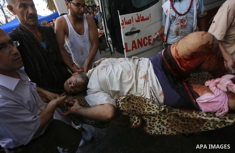 Palestinian medics wheel a wounded man, following an Israeli Strike in Shijaiyah neighborhood, to the emergency room of the Shifa Hospital, in Gaza City, Wednesday, July 30, 2014. Photo by Mohammed Asad