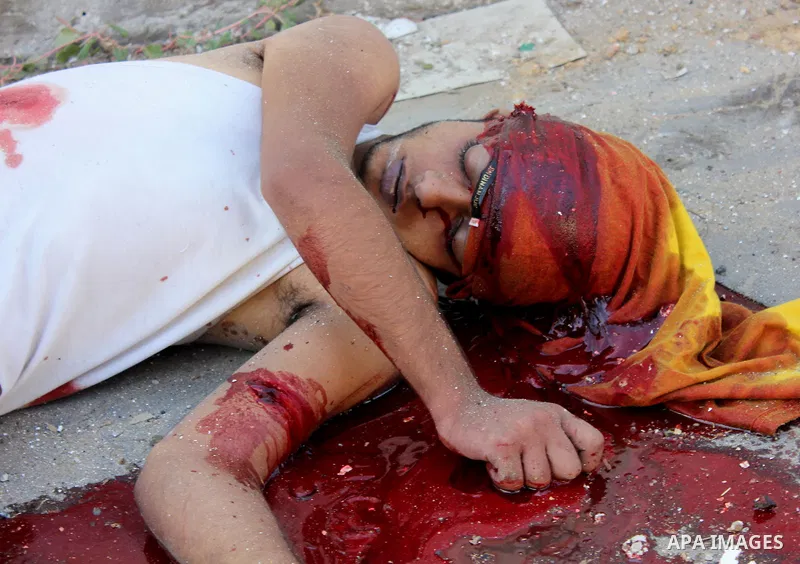 A Palestinian lays on the ground following an Israeli Strike in Shijaiyah neighborhood, eastern Gaza City, Wednesday, July 30, 2014. . Photo by Omar Abed