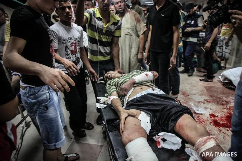 Palestinians wheel a wounded man, injured from an Israeli Strike in Shijaiyah neighborhood, to an emergency room at Shifa Hospital, in Gaza City, Wednesday, July 30, 2014. Photo by Ezz al-Zanoun