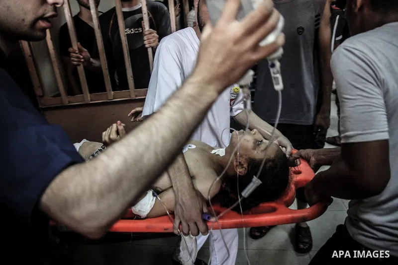 Palestinians wheel a wounded man, injured from an Israeli Strike in Shijaiyah neighborhood, to an emergency room at Shifa Hospital, in Gaza City, Wednesday, July 30, 2014. Photo by Ezz al-Zanoun