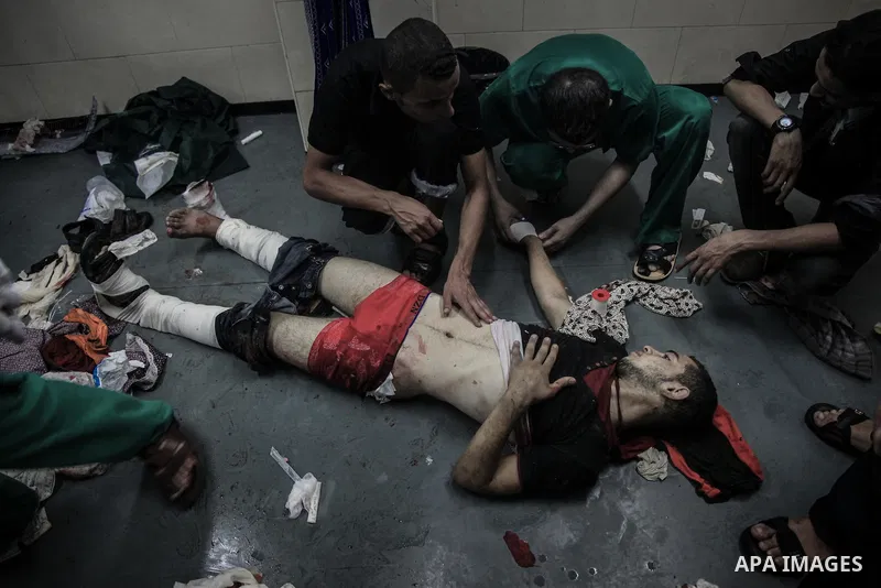Palestinians wheel a wounded man, injured from an Israeli Strike in Shijaiyah neighborhood, to an emergency room at Shifa Hospital, in Gaza City, Wednesday, July 30, 2014. Photo by Ezz al-Zanoun