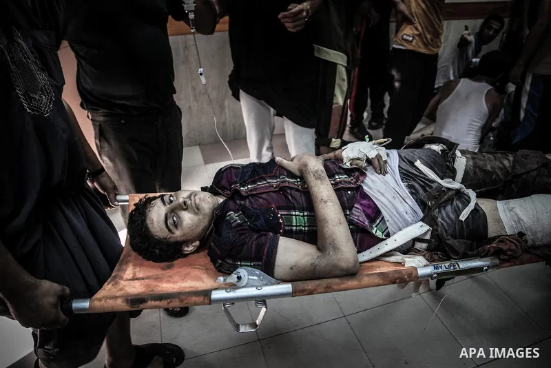 Palestinians wheel a wounded man, injured from an Israeli Strike in Shijaiyah neighborhood, to an emergency room at Shifa Hospital, in Gaza City, Wednesday, July 30, 2014. Photo by Ezz al-Zanoun