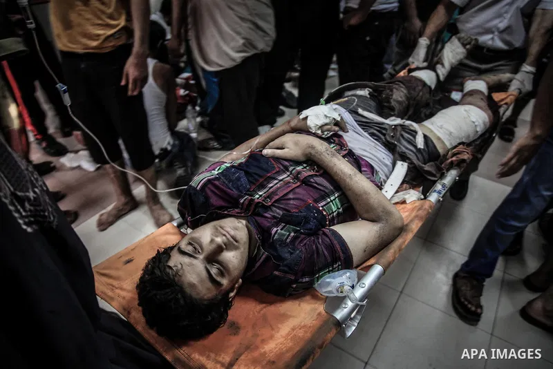 Palestinians wheel a wounded man, injured from an Israeli Strike in Shijaiyah neighborhood, to an emergency room at Shifa Hospital, in Gaza City, Wednesday, July 30, 2014. Photo by Ezz al-Zanoun