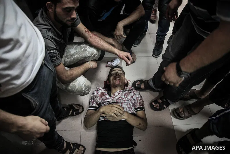 Palestinians wheel a wounded man, injured from an Israeli Strike in Shijaiyah neighborhood, to an emergency room at Shifa Hospital, in Gaza City, Wednesday, July 30, 2014. Photo by Ezz al-Zanoun