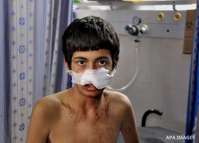 A Palestinian, boy whom medics said was wounded in an Israeli air strike at a hospital in Gaza City July 31, 2014. Israeli Prime Minister Benjamin Netanyahu, facing international alarm over a rising civilian death toll i...