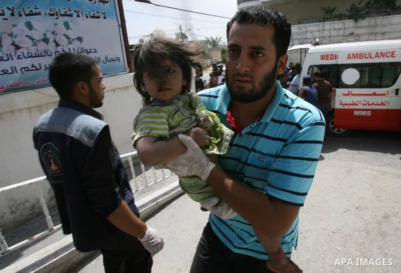 An injured Palestinian child receives medical treatment at al-Najar hospital in Rafah in the southern of Gaza strip, following an Israeli military strike on August 1, 2014. Egypt told Palestinian officials it is delaying...