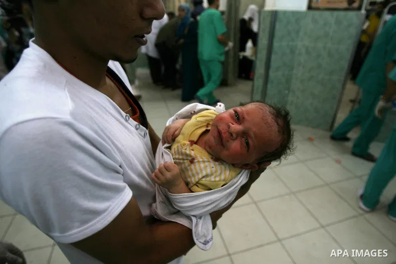 An injured Palestinian child receives medical treatment at al-Najar hospital in Rafah in the southern of Gaza strip, following an Israeli military strike on August 1, 2014. Egypt told Palestinian officials it is delaying...