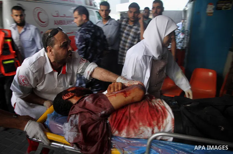 An injured Palestinian man receives medical treatment at al-shifa hospital in Gaza city , following an Israeli military strike on August 1, 2014. Egypt told Palestinian officials it is delaying ceasefire talks in Cairo a...