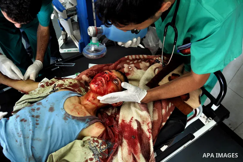 An injured Palestinian boy receives medical treatment at al-shifa hospital in Gaza city , following an Israeli military strike on August 1, 2014. Egypt told Palestinian officials it is delaying ceasefire talks in Cairo a...